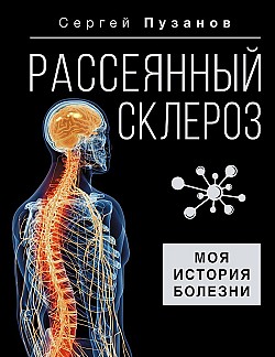 Рассеянный склероз. Моя история болезни Сергей Пузанов